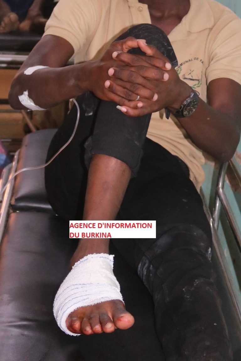 Fada N’Gourma : Plusieurs élèves blessés suite à des échauffourées avec les FDS